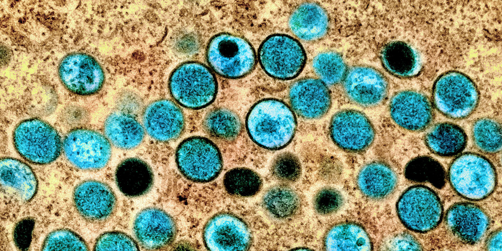 Monkey Pox Virus