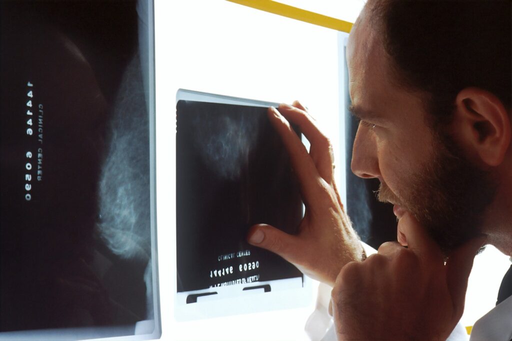 A doctor looks at X-rays.