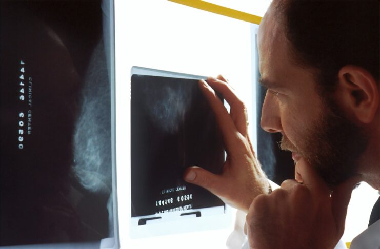 A doctor looks at X-rays.